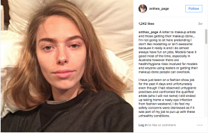 Australian model Anthea Page gets eye infection requiring medication from a dirty makeup brush. News follows other cases of dirty makeup brushes causing breakouts and infections, including the story of an Australian mother who was paralyzed by a dirty makeup brush.
